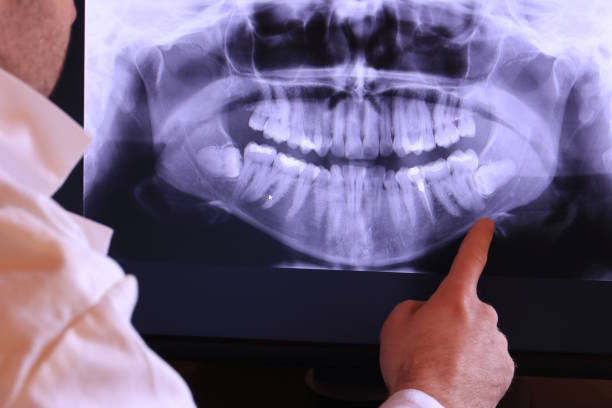 Best Emergency Dentist for Knocked-Out Tooth in Concord, AL